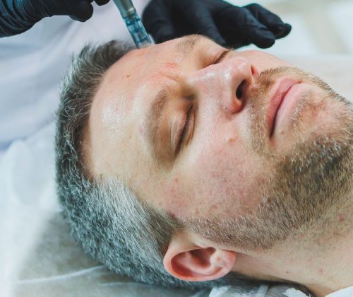 kosmetologia hi-tech dla mężczyzn we Wrocławiu