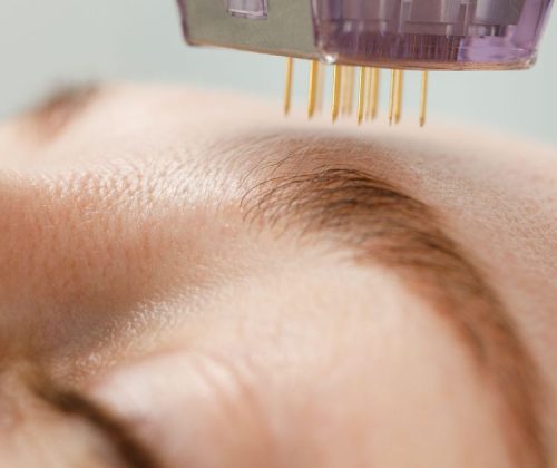 kosmetologia hi-tech we Wrocławiu