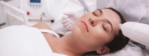 laserowe usuwanie przebarwień