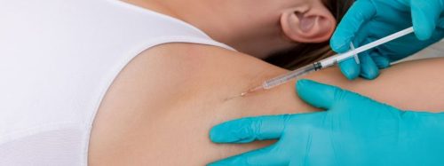 leczenie nadpotliwości botoksem