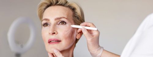 nieoperacyjny lifting twarzy