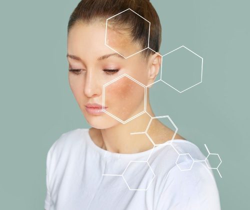 nierówny koloryt skóry