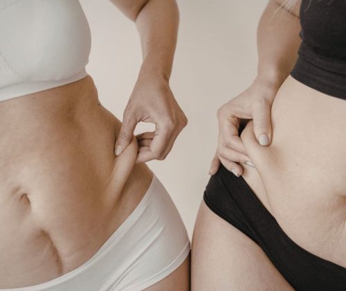 wymodelowanie sylwetki